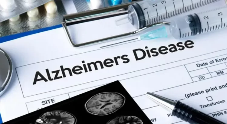 Lanzan al mercado la primera prueba de Alzheimer